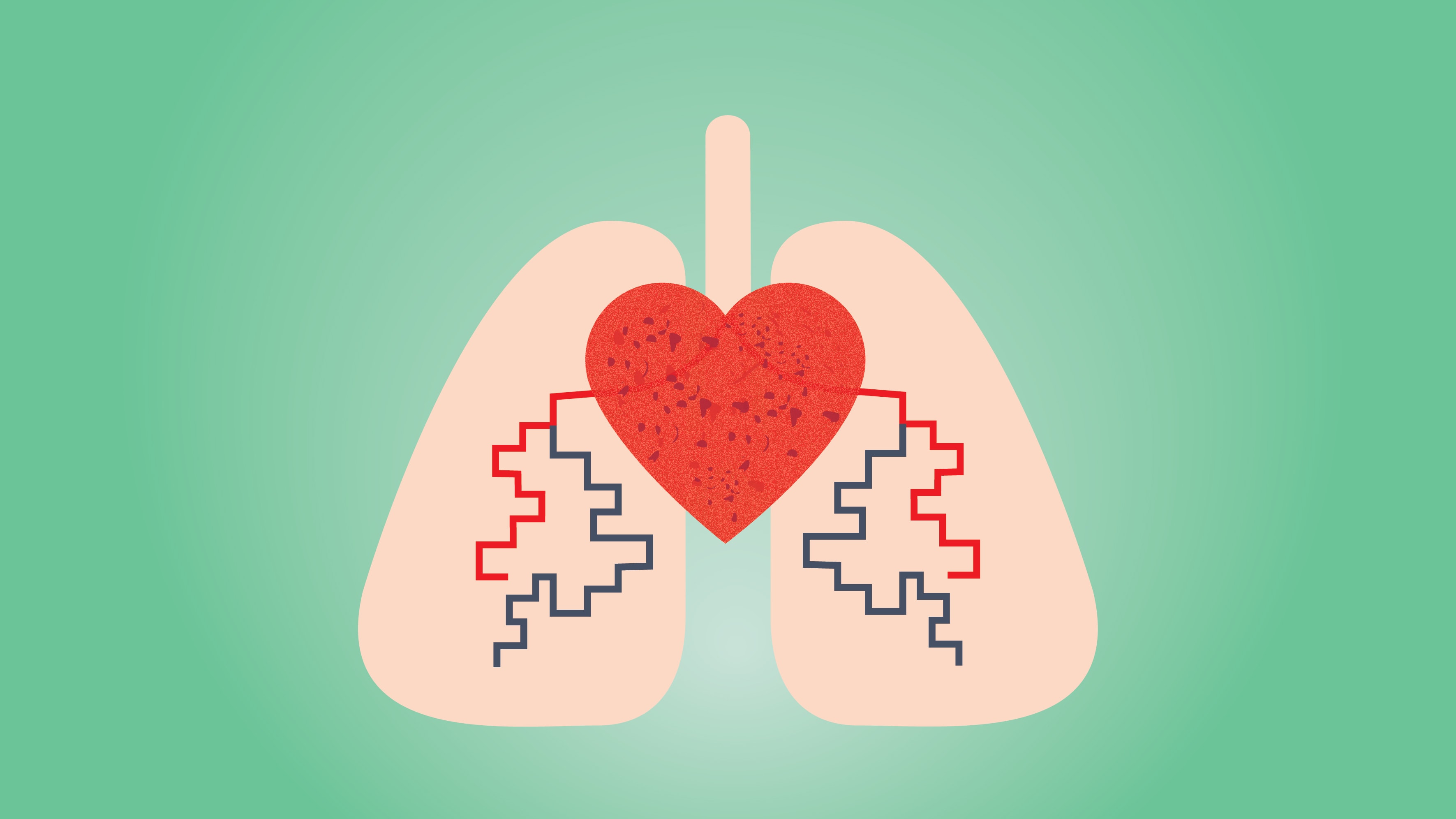 心脏和肺部肺动脉高压的图形