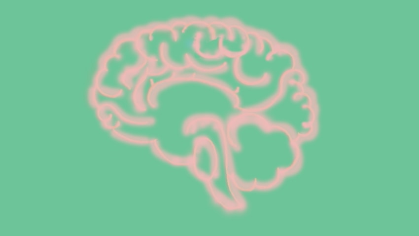 一幅患有帕金森氏症的大脑的画