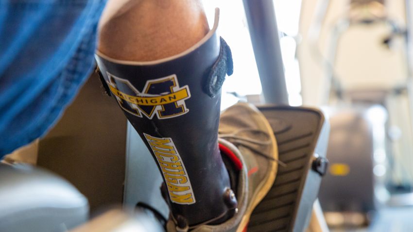 一名男子的腿上戴着密歇根大学的支架。