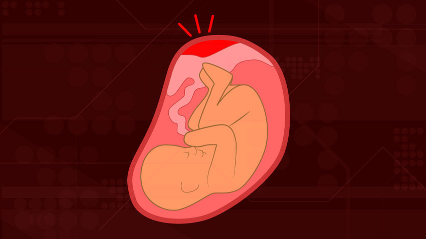 黑色背景的婴儿，红色的胎盘，顶部有红色的斑点，表明有什么不对劲