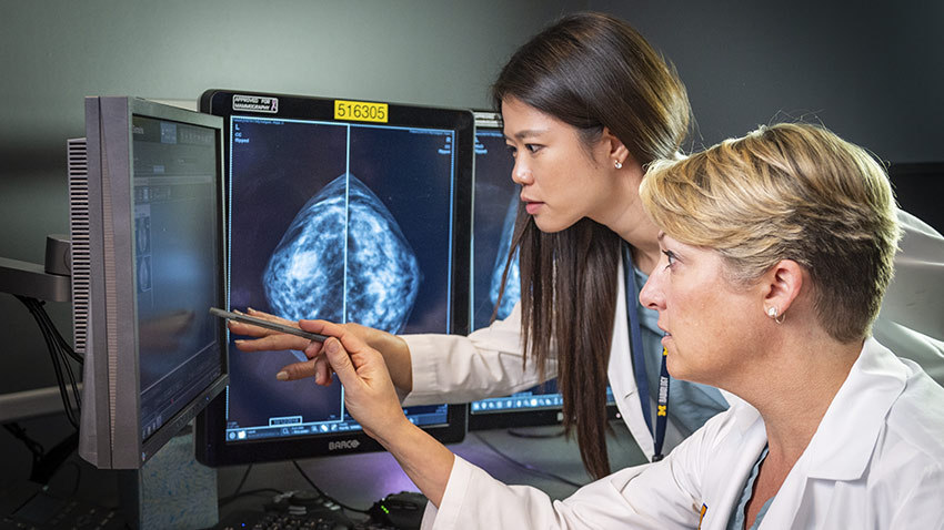 医生指着电脑扫描电脑上的乳房X光片