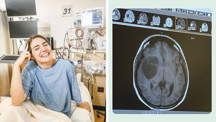 一个女人坐在医院的病床上，微笑着穿着蓝色的长袍，右边的脑部扫描图上有肿瘤