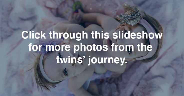 单击此幻灯片以获取双胞胎旅程的更多照片。