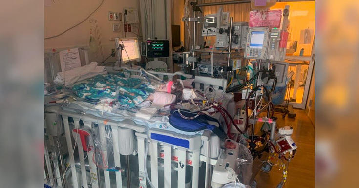 婴儿躺在医院的病床上，身上插着管子和电线